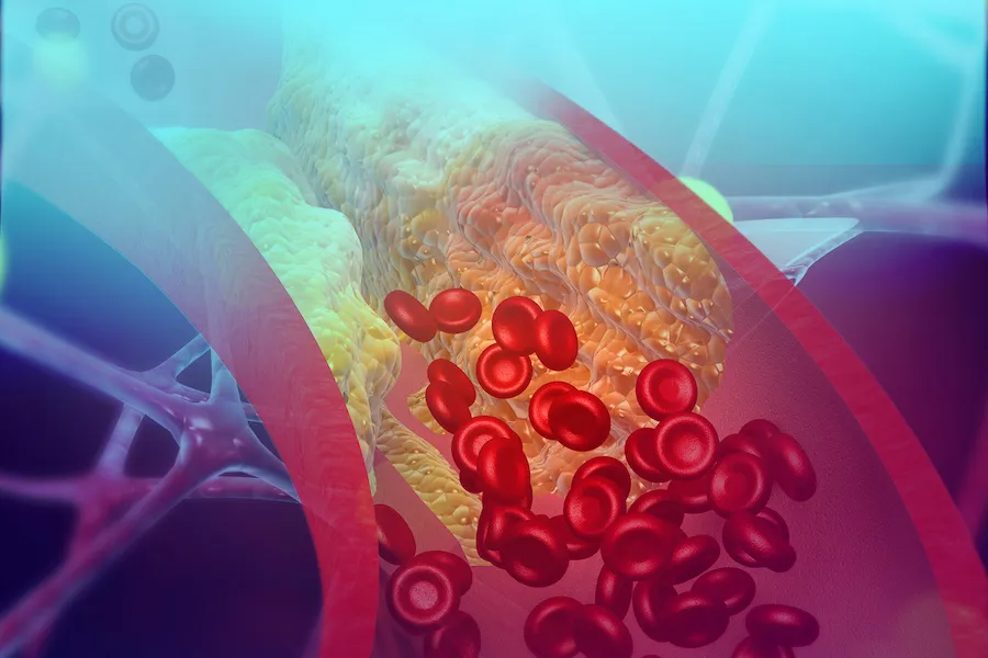 Lower Cholesterol Levels Naturally
